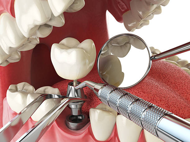 Best Urgent Dental Care  in Ferdand, IN